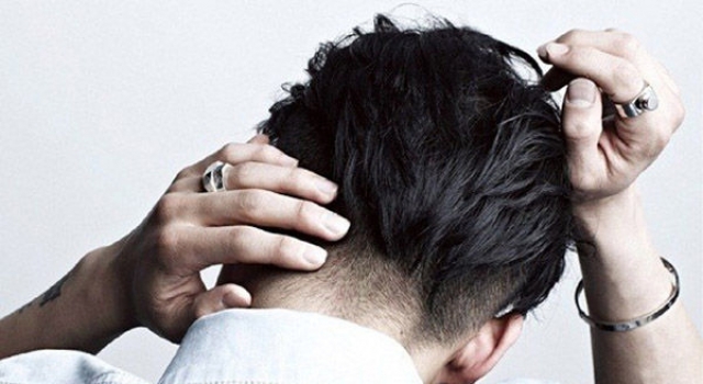 四招搞定男性脱发烦恼 聪明不“绝顶”