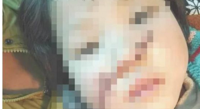 电锯惊魂!10岁女童模仿光头强 用电锯锯开妹妹的鼻子
