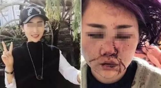 丽江被打女游客与被告人和解 时长1年诉讼终结束