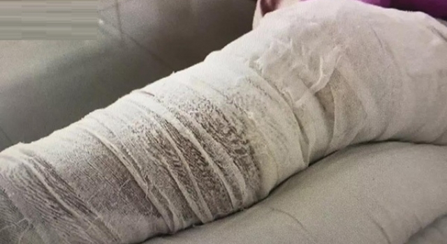 右腿手术左腿被开怎么回事?这样的医疗事故太奇葩!