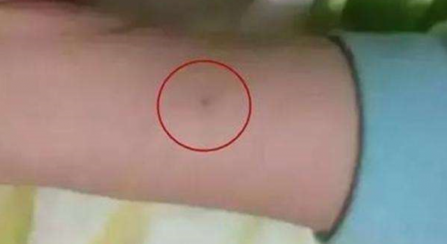 曝幼儿园针扎幼儿怎么回事 虐童还想拿钱摆平?不能忍!