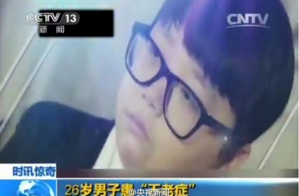 26岁男子患“不老症” 青春常驻也苦恼(图)