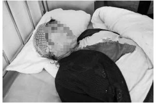 凭啥?老太就餐摔伤后死于心脏病 家属向餐厅索赔100万