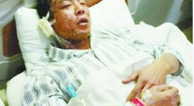厦门一工人给空调加氨发生爆炸 工人右耳被炸穿血肉模糊