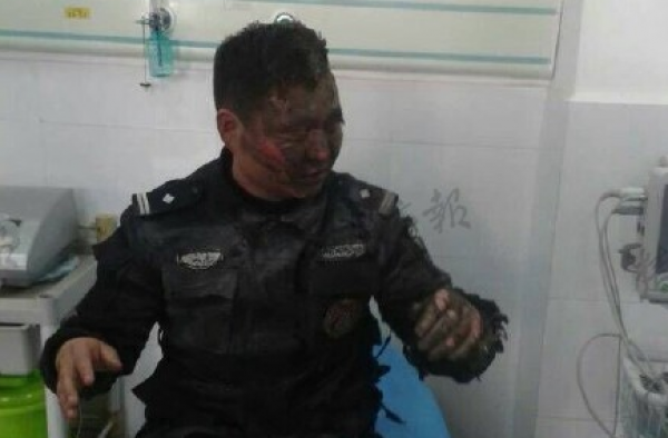 黄冈警察身体压住“土炸弹”保全他人 残疾毁容仍无悔