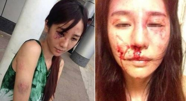 女律师遭夫家暴：手脚筋被挑断 母亲受多刀颅骨被敲碎