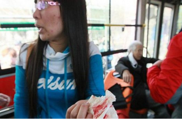 女子给妇女让座反遭掌掴 因问＂你是孕妇吧＂被疑讥讽