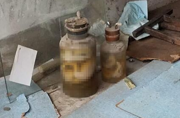 诊所现完整婴儿标本 用药水浸泡在一个玻璃罐中