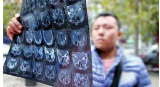只因在人群中多看了一眼!小伙遭吵架情侣打成脑震荡