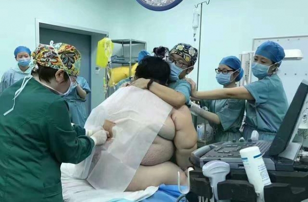 280斤孕妇临盆 16名医务人员为其接生