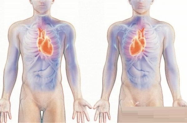 男子五脏六腑颠倒怎么回事？直肠癌切除手术愁坏医生