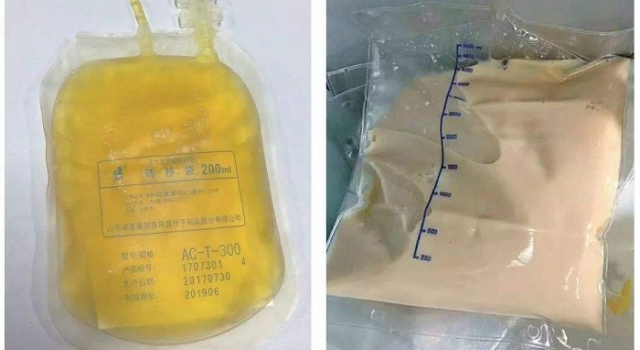 女子三餐吃外卖血浆变成猪油色 外卖：这个锅我不背！