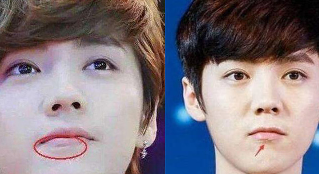 鹿晗脸上有疤吗？扒一扒脸上有疤的男明星们