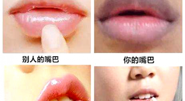 嘴唇周围发黑是什么原因 如何改善嘴巴周围发黑