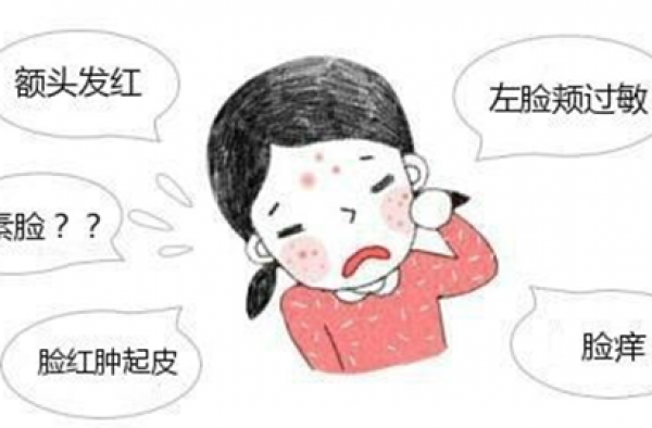 怎么治疗激素脸好得快？激素脸怎么治才能好