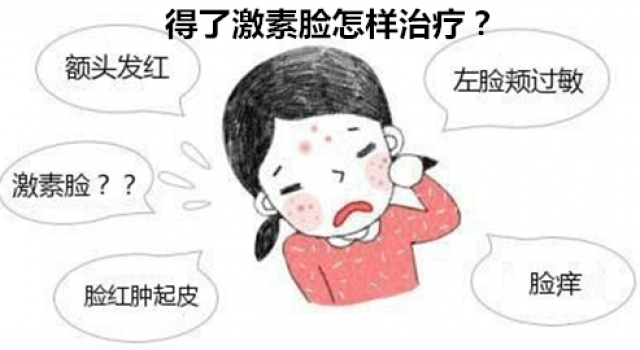 得了激素脸怎样治疗？激素脸一般多久能治愈