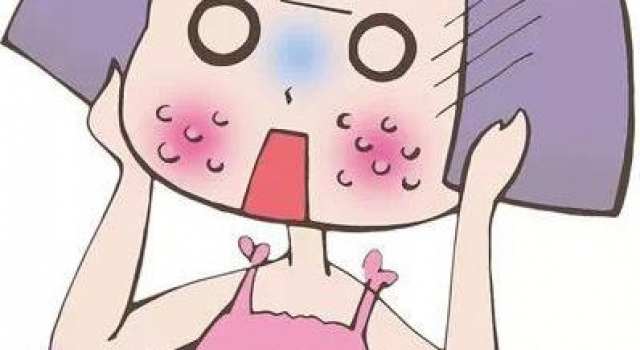 激素脸为什么会肿？详解激素脸红肿脱皮怎么办