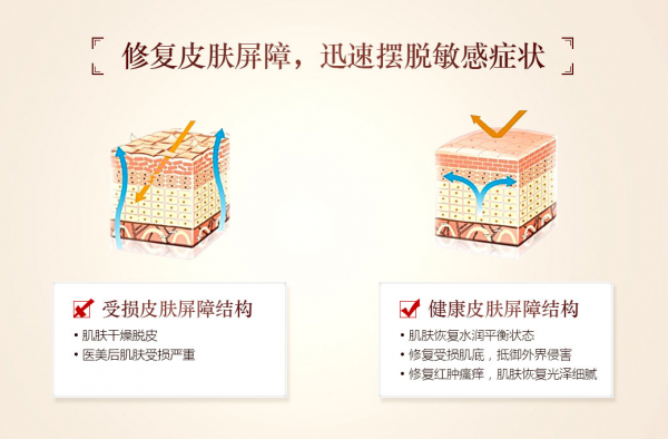 激素脸皮肤薄爱过敏怎么办？脸遇热红烫痒闷粉刺角质层变薄怎么修复