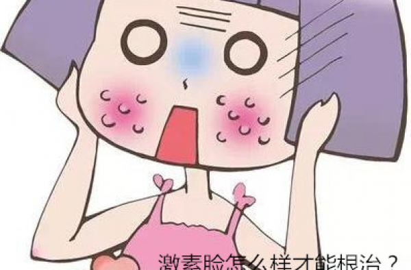 激素脸怎么样才能根治？激素脸多久才能彻底治愈