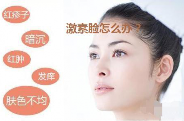 怎么样治疗激素脸？详解激素脸反跳期一般多久