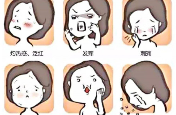 轻度激素脸有什么症状？分享怎样测自己是激素脸