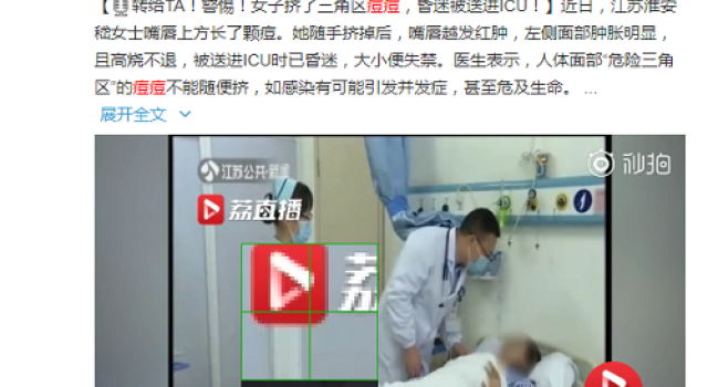 美丽策美容仪让你用最有效最安全的方法祛痘！