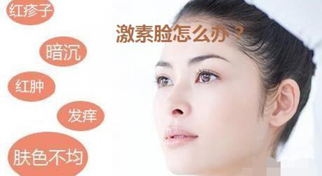得了激素脸该怎么办？激素脸的治疗方法用什么好