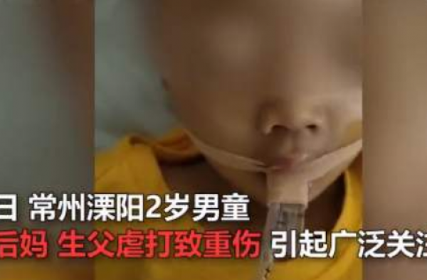 男童疑遭虐打去世 真相是什么？是谁动的手？