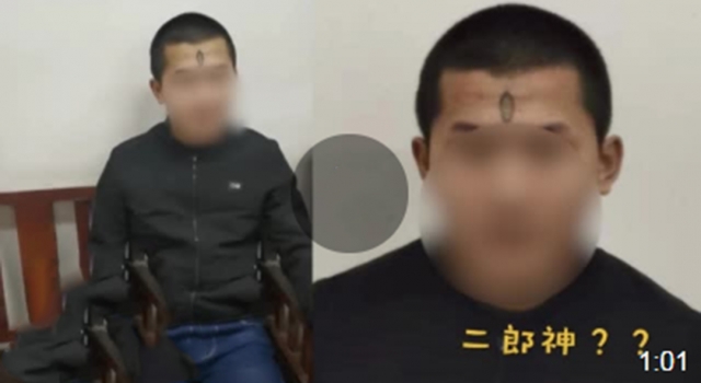 小伙追求时尚额头文天眼 网友：这追求的分明是童真