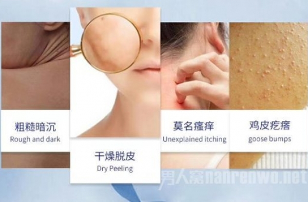 去鸡皮肤产品排行榜，用它重塑婴儿肌