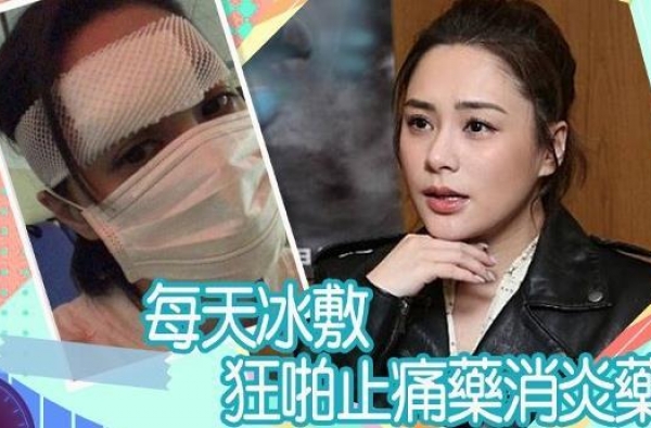 破相风险！阿娇头部表面一层已缝66针 主刀院长由任达华介绍