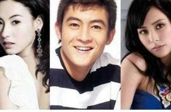 阿娇撞伤头缝上百针后，张柏芝也晒满脸纱布照，网友忙问受伤了？