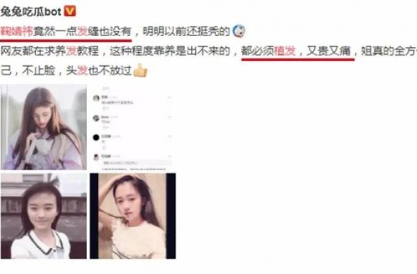鞠婧祎连头皮都整了？对自己也太狠了吧