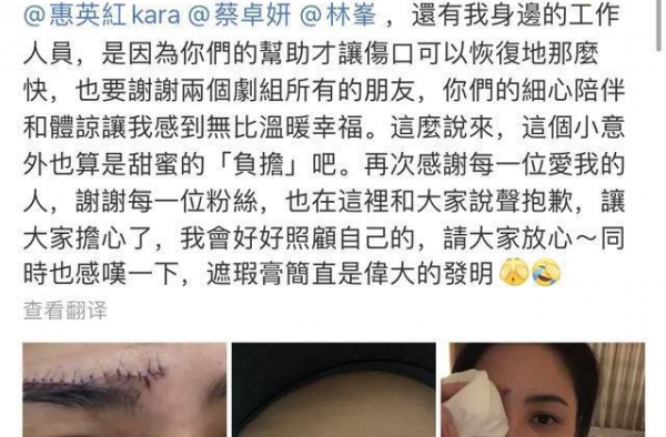 阿娇事故后首现身！自拍照＂蜈蚣＂伤口触目惊心，还好没毁容