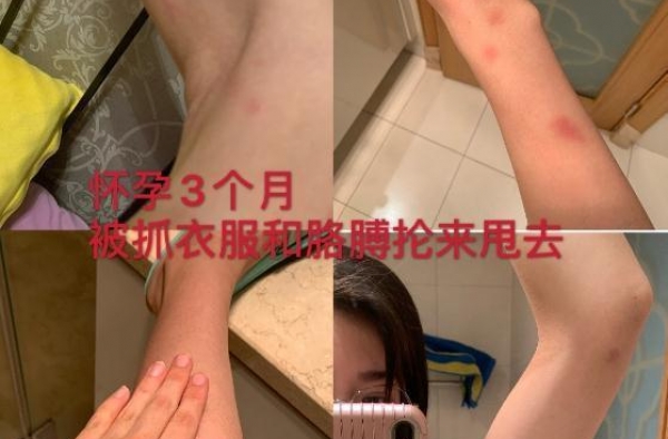 “百米双雄”张培萌被曝家暴，妻子是NBA、足球、LOL女主持