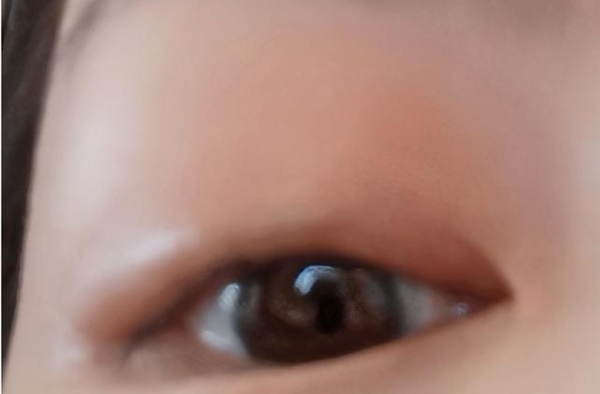 唐嫣太敬业！眼睛得了麦粒肿还坚持工作，网上求助网友们支妙招
