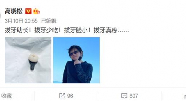 高晓松剪掉25年长头发！穿五千上衣钓鱼，肚子平坦无一点赘肉